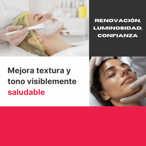 PEELING QUÍMICO