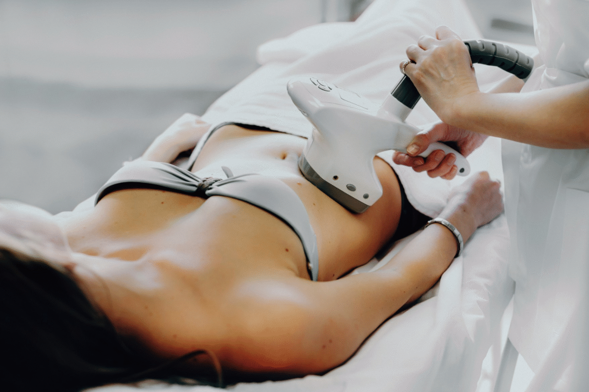 Abdomen + Espalda lipoescultura sin cirugía