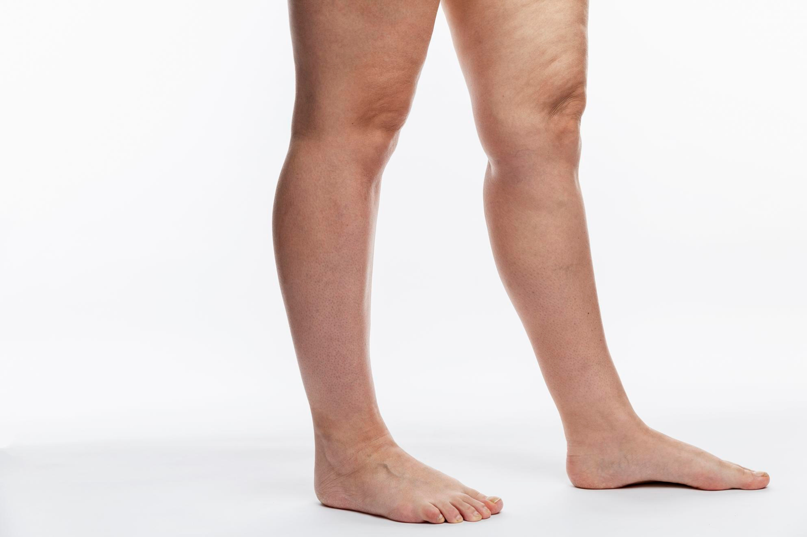 Piernas Completas Hombre