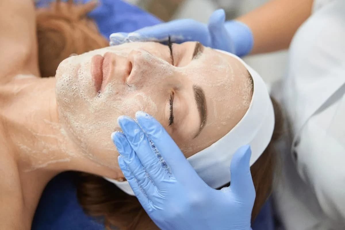Peeling Facial